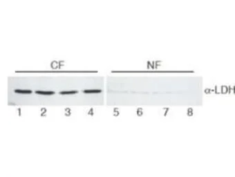 Anti-Lactate Dehydrogenase antibody used in Western Blot (WB). GTX22101