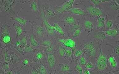 Anti-Lactate Dehydrogenase antibody used in Immunocytochemistry/ Immunofluorescence (ICC/IF). GTX22101