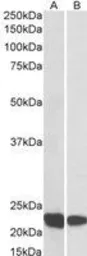 Anti-RAC2 antibody used in Western Blot (WB). GTX22244