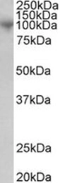 Anti-ADAM8 antibody used in Western Blot (WB). GTX22475