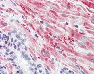 Anti-Glycogen synthase 1 (phospho Ser641) antibody used in IHC (Paraffin sections) (IHC-P). GTX22479
