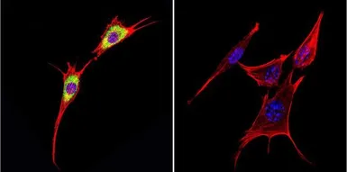 Anti-Cytohesin 1 antibody [2E11] used in Immunocytochemistry/ Immunofluorescence (ICC/IF). GTX22727