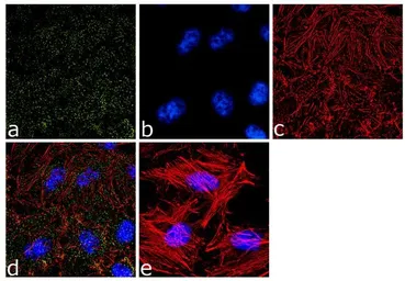 Anti-alpha Adaptin antibody [AP6] used in Immunocytochemistry/ Immunofluorescence (ICC/IF). GTX22730