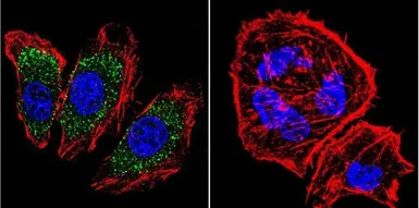 Anti-alpha Adaptin antibody [AP6] used in Immunocytochemistry/ Immunofluorescence (ICC/IF). GTX22730