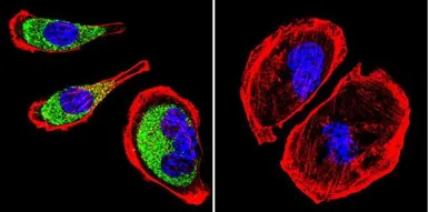 Anti-Clathrin Heavy chain antibody [X22] used in Immunocytochemistry/ Immunofluorescence (ICC/IF). GTX22731