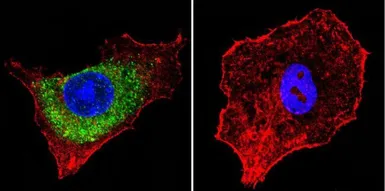 Anti-IGF2R antibody [2G11] used in Immunocytochemistry/ Immunofluorescence (ICC/IF). GTX22733
