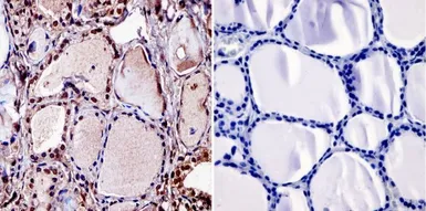 Anti-Thyroid Hormone Receptor beta antibody [J52] used in IHC (Paraffin sections) (IHC-P). GTX22744