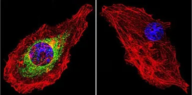 Anti-Glucocorticoid Receptor antibody [BuGR2] used in Immunocytochemistry/ Immunofluorescence (ICC/IF). GTX22768