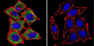 Anti-Mineralocorticoid Receptor antibody [H10E4C9F] used in Immunocytochemistry/ Immunofluorescence (ICC/IF). GTX22774