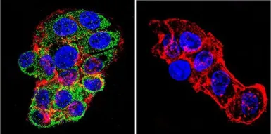 Anti-Mineralocorticoid Receptor antibody [H10E4C9F] used in Immunocytochemistry/ Immunofluorescence (ICC/IF). GTX22774