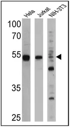 Anti-PPAR alpha antibody [3B6/PPAR] used in Western Blot (WB). GTX22779