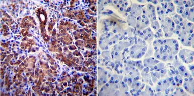 Anti-CFTR antibody [CF3] used in IHC (Paraffin sections) (IHC-P). GTX22784