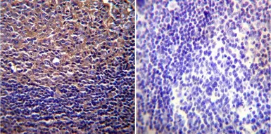 Anti-CFTR antibody [CF3] used in IHC (Paraffin sections) (IHC-P). GTX22784