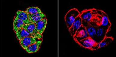 Anti-CFTR antibody [CF3] used in Immunocytochemistry/ Immunofluorescence (ICC/IF). GTX22784