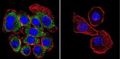 Anti-CFTR antibody [CF3] used in Immunocytochemistry/ Immunofluorescence (ICC/IF). GTX22784