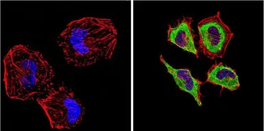 Anti-Endothelin 1 antibody [TR.ET.48.5] used in Immunocytochemistry/ Immunofluorescence (ICC/IF). GTX22786
