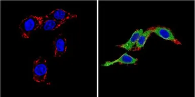 Anti-Endothelin 1 antibody [TR.ET.48.5] used in Immunocytochemistry/ Immunofluorescence (ICC/IF). GTX22786