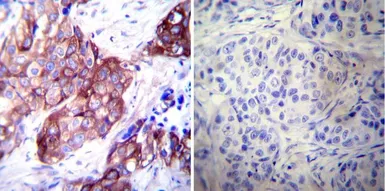 Anti-HSP27 antibody [G3.1] used in IHC (Paraffin sections) (IHC-P). GTX22790