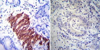 Anti-HSP27 antibody [G3.1] used in IHC (Paraffin sections) (IHC-P). GTX22790