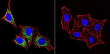 Anti-HSP27 antibody [G3.1] used in Immunocytochemistry/ Immunofluorescence (ICC/IF). GTX22790