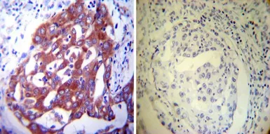 Anti-PDI antibody [RL90] used in IHC (Paraffin sections) (IHC-P). GTX22792