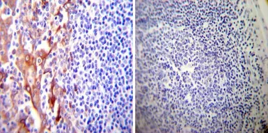 Anti-PDI antibody [RL90] used in IHC (Paraffin sections) (IHC-P). GTX22792