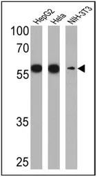 Anti-PDI antibody [RL90] used in Western Blot (WB). GTX22792