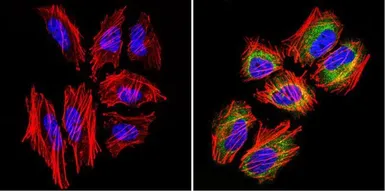Anti-TCP1 alpha antibody [91A] used in Immunocytochemistry/ Immunofluorescence (ICC/IF). GTX22797