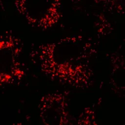 Anti-Calnexin antibody [AF18] used in Immunocytochemistry/ Immunofluorescence (ICC/IF). GTX22798