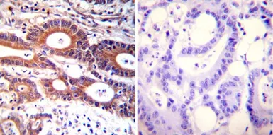 Anti-ARF1/ARF3/ARF5/ARF6 antibody [1D9] used in IHC (Paraffin sections) (IHC-P). GTX22806
