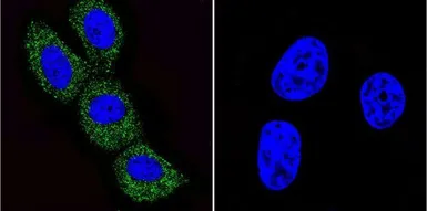 Anti-ARF1/ARF3/ARF5/ARF6 antibody [1D9] used in Immunocytochemistry/ Immunofluorescence (ICC/IF). GTX22806