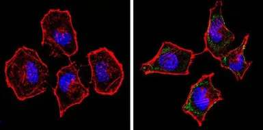 Anti-Spectrin beta 1 antibody [4C3] used in Immunocytochemistry/ Immunofluorescence (ICC/IF). GTX22808
