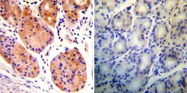 Anti-Rab9 antibody [Mab9] used in IHC (Paraffin sections) (IHC-P). GTX22810