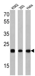 Anti-Rab9 antibody [Mab9] used in Western Blot (WB). GTX22810