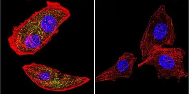 Anti-Rab9 antibody [Mab9] used in Immunocytochemistry/ Immunofluorescence (ICC/IF). GTX22810