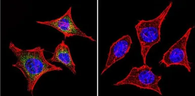 Anti-Rab9 antibody [Mab9] used in Immunocytochemistry/ Immunofluorescence (ICC/IF). GTX22810