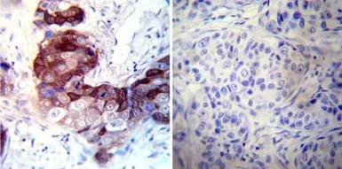 Anti-CRABP1 antibody [C-1] used in IHC (Paraffin sections) (IHC-P). GTX22816