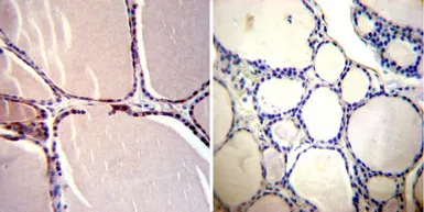 Anti-CRABP1 antibody [C-1] used in IHC (Paraffin sections) (IHC-P). GTX22816