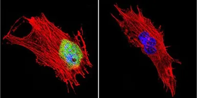 Anti-CRABP1 antibody [C-1] used in Immunocytochemistry/ Immunofluorescence (ICC/IF). GTX22816