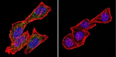 Anti-CRABP1 antibody [C-1] used in Immunocytochemistry/ Immunofluorescence (ICC/IF). GTX22816