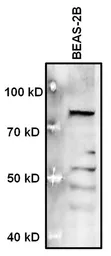 Anti-MECP2 antibody used in Western Blot (WB). GTX22828