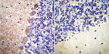 Anti-Calmodulin antibody [2D1] used in IHC (Paraffin sections) (IHC-P). GTX22860