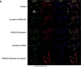 Anti-Sodium Potassium ATPase antibody [9-A5] used in Immunocytochemistry/ Immunofluorescence (ICC/IF). GTX22867