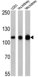 Anti-Sodium/Potassium ATPase alpha 1 antibody [M7-PB-E9] used in Western Blot (WB). GTX22871