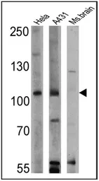Anti-RASA1 antibody [B4F8] used in Western Blot (WB). GTX22922