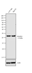Anti-SNAP23 antibody used in Western Blot (WB). GTX23340