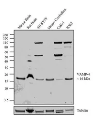 Anti-VAMP4 antibody used in Western Blot (WB). GTX23348