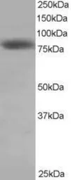 Anti-Hec1 antibody, C-term used in Western Blot (WB). GTX23393