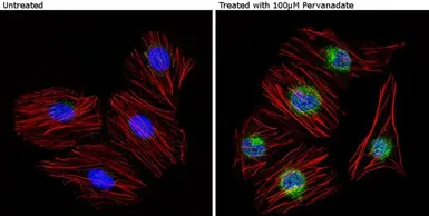 Anti-Caveolin 2 (phospho Tyr19) antibody used in Immunocytochemistry/ Immunofluorescence (ICC/IF). GTX23417