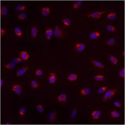 Anti-PMP70 antibody used in Immunocytochemistry/ Immunofluorescence (ICC/IF). GTX23421
